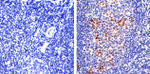 FOXP3 Antibody in Immunohistochemistry (Paraffin) (IHC (P))