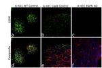 EGFR Antibody in Immunocytochemistry (ICC/IF)