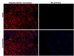 EGFR Antibody in Immunohistochemistry (Paraffin) (IHC (P))