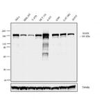 EGFR Antibody in Western Blot (WB)