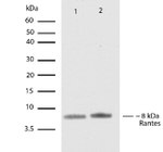 CCL5 (RANTES) Antibody in Western Blot (WB)