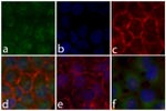 Phospho-STAT5 alpha (Tyr694) Antibody in Immunocytochemistry (ICC/IF)