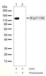 Phospho-INSR (Tyr1158) Antibody in Western Blot (WB)