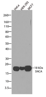 alpha Synuclein Antibody in Western Blot (WB)