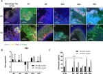 Fibronectin Antibody in Immunohistochemistry (IHC)