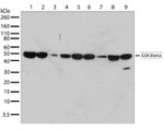 GSK3B Antibody in Western Blot (WB)