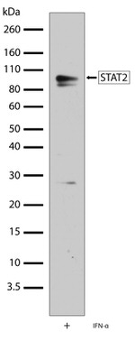 STAT2 Antibody in Western Blot (WB)