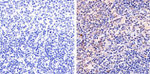 STAT5 beta Antibody in Immunohistochemistry (Paraffin) (IHC (P))