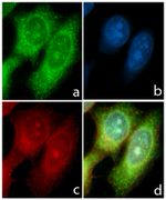 STAT6 Antibody in Immunocytochemistry (ICC/IF)