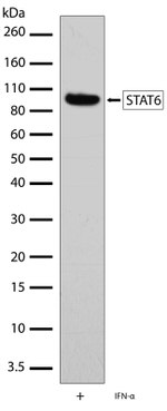 STAT6 Antibody in Western Blot (WB)