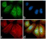 PDGFRA Antibody in Immunocytochemistry (ICC/IF)