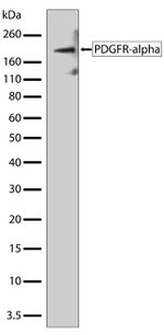 PDGFRA Antibody in Western Blot (WB)