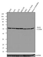 PAX3 Antibody in Western Blot (WB)