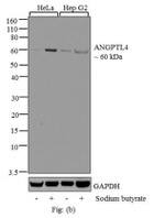 ANGPTL4 Antibody in Western Blot (WB)