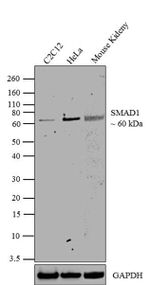 SMAD1 Antibody in Western Blot (WB)