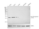 beta-2 Microglobulin Antibody in Western Blot (WB)