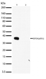 Phospho-EIF2S1 (Ser51) Antibody