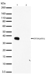 Phospho-EIF2S1 (Ser51) Antibody in Western Blot (WB)