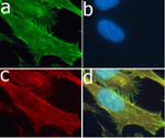 MMP3 Antibody in Immunocytochemistry (ICC/IF)