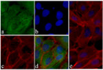 MMP3 Antibody in Immunocytochemistry (ICC/IF)