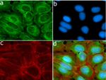 MMP13 Antibody in Immunocytochemistry (ICC/IF)