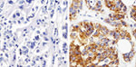 MMP13 Antibody in Immunohistochemistry (Paraffin) (IHC (P))