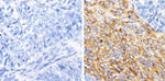 MMP13 Antibody in Immunohistochemistry (Paraffin) (IHC (P))