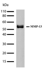 MMP13 Antibody in Western Blot (WB)