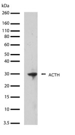 ACTH Antibody in Western Blot (WB)