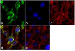 SHH Antibody in Immunocytochemistry (ICC/IF)