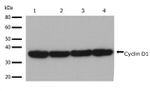 Cyclin D1 Antibody in Western Blot (WB)