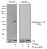 Phospho-SMAD2 (Ser465, Ser467) Antibody in Western Blot (WB)