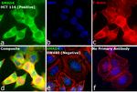 SMAD4 Antibody in Immunocytochemistry (ICC/IF)