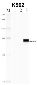 SMAD4 Antibody in RNA Immunoprecipitation (RIP)