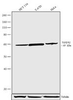 TGFBR2 Antibody in Western Blot (WB)