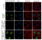 Phospho-SMAD2 (Ser245, Ser250) Antibody