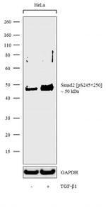 Phospho-SMAD2 (Ser245, Ser250) Antibody