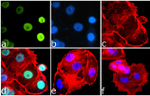 Phospho-IRS1 (Ser616) Antibody in Immunocytochemistry (ICC/IF)