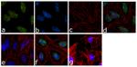 H3K79me2 Antibody in Immunocytochemistry (ICC/IF)