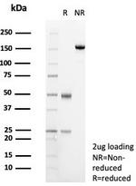 Transferrin (Early Marker of Oligodendrocytes) Antibody in SDS-PAGE (SDS-PAGE)