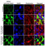 Phospho-S6 (Ser240, Ser244) Antibody in Immunocytochemistry (ICC/IF)