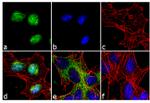 FOXO3A Antibody