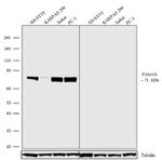 FOXO3A Antibody in Western Blot (WB)