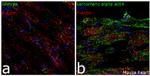 alpha Actinin 2 Antibody in Immunohistochemistry (Frozen) (IHC (F))