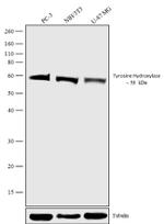 Tyrosine Hydroxylase Antibody in Western Blot (WB)