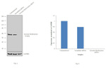 Tyrosine Hydroxylase Antibody