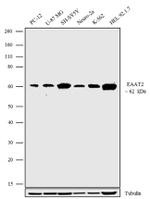 GLT-1 Antibody in Western Blot (WB)