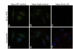 Glutamine Synthetase Antibody