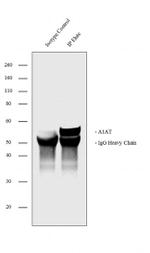 alpha-1 Antitrypsin Antibody in Western Blot (WB)