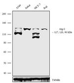 TERT Antibody in Western Blot (WB)